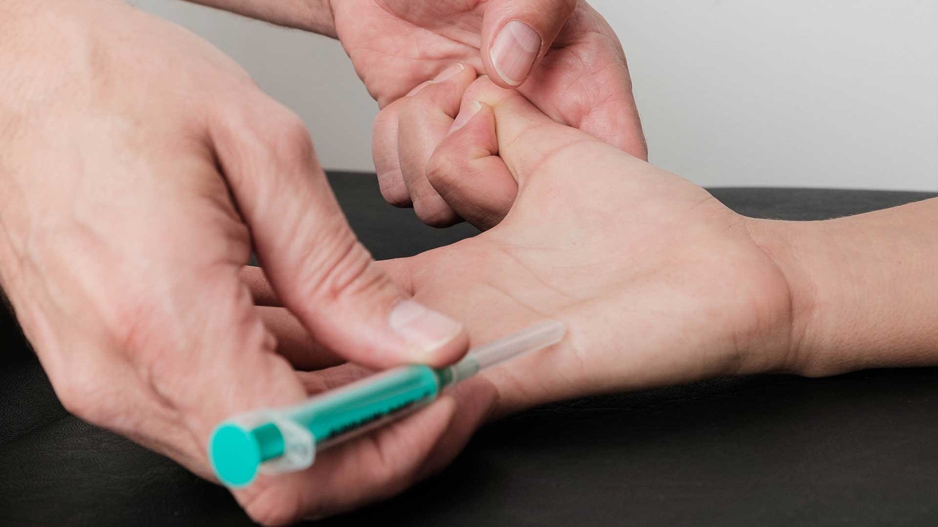 Lokalna blokada boli u živac Lokalna-blokada-boli-u-zivac