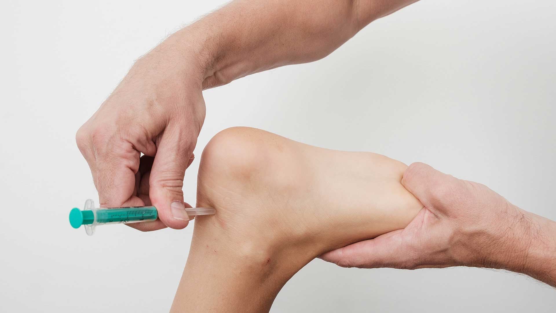 Lokalna-blokada-boli-tetive-i-ligamenta