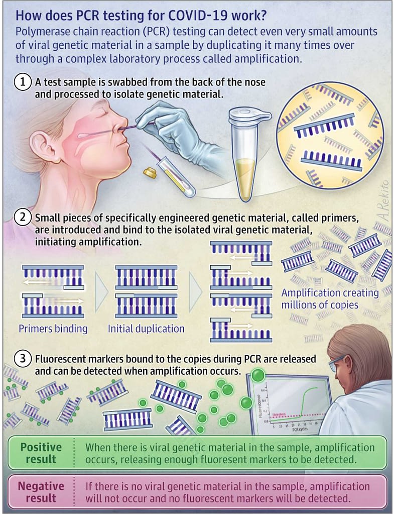 PCR (polymerase chain reaction) dijagnostika u medicini pcr for covid 19